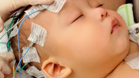 Baby is getting their brain scanned