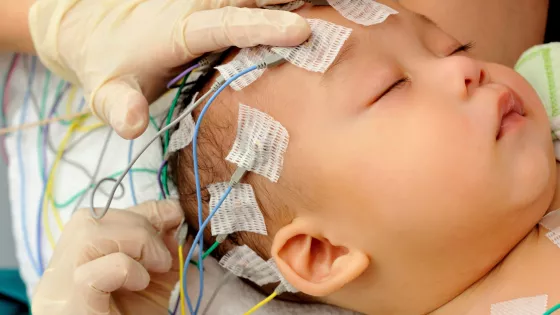 A sleeping baby with electrodes on their head.