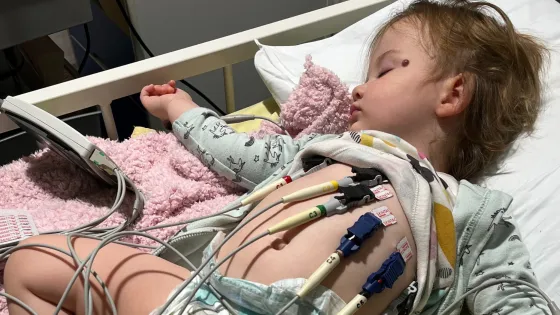 Young girl is sleeping on a on hospital bed with electrodes attached to her body