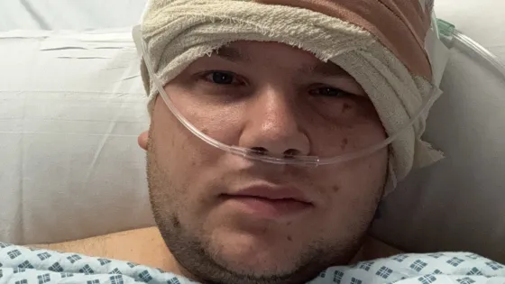 A young man lies in a hospital bed with a nose tube and a bandaged head.