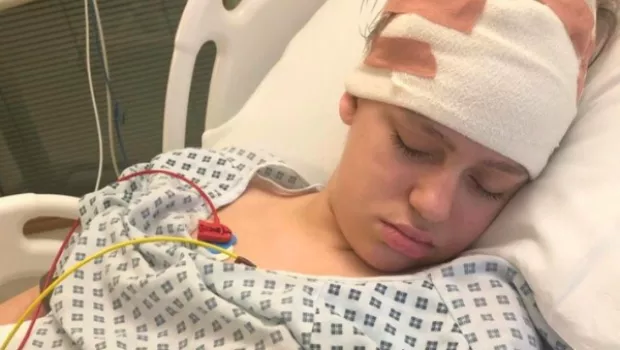 Young girl sleeping on hospital bed with bandages on head.