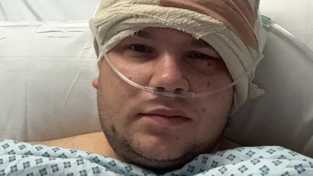 A young man lies in a hospital bed with a nose tube and a bandaged head.