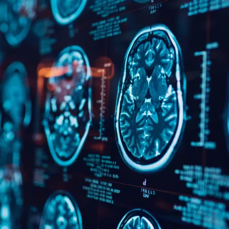 Learn more about epilepsy research