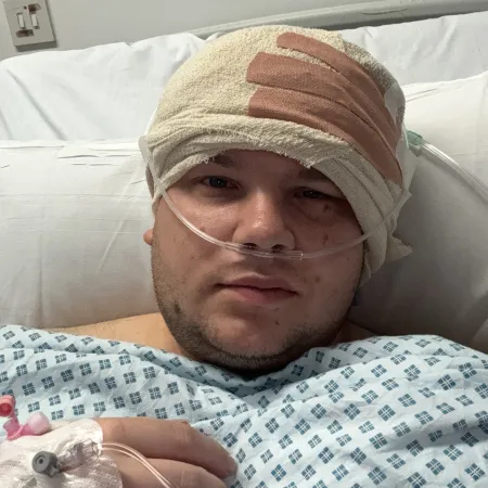A young man lies in a hospital bed with a nose tube and a bandaged head.