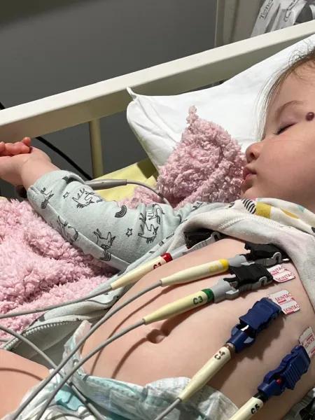 Young girl is sleeping on hospital bed with electrodes attached to her body