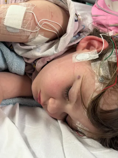 A young girl sleeps in a hospital bed with lots of tubes and patches on her head and arms.
