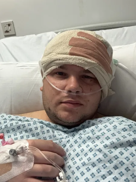 A young man lies in a hospital bed with a nose tube and a bandaged head.